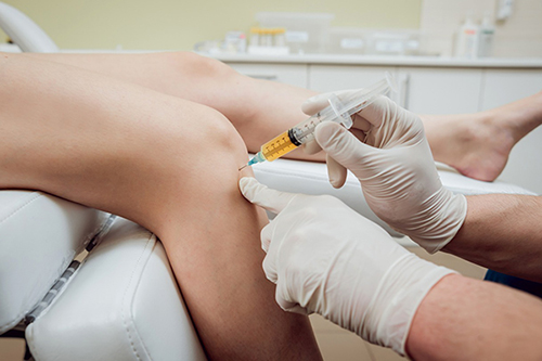 Can PRP Help Knee Osteoarthritis in Bellaire, Texas?