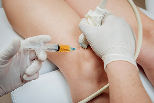 PRP Combination Therapy