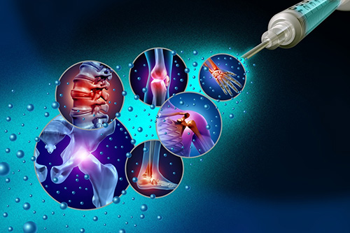 Regenerative Medicine Houston: Natural Healing Solutions for Joint and Sports Injuries