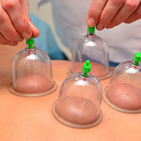 Cupping or Vacuum Therapy
