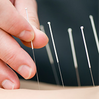 Medical Acupuncture