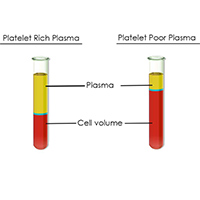 PPP - Platelet Poor Plasma