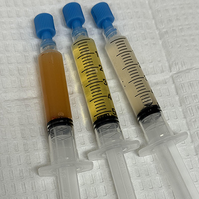 Platelet Rich Plasma Therapy