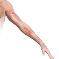 Shoulder and Arm Pain