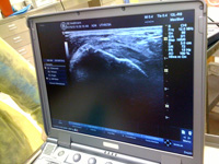 Ultrasound Diagnosis